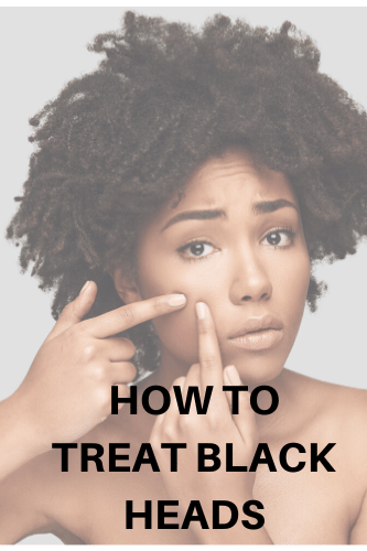 How To Treat Black Heads