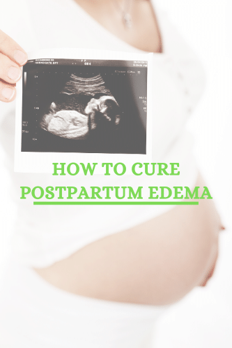 “How To Cure Postpartum Edema

“